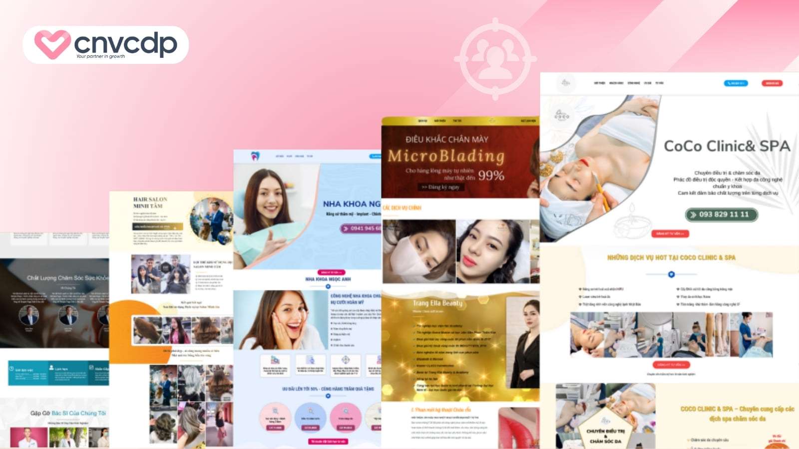 Luu y khi trien khai mau landing page Spa