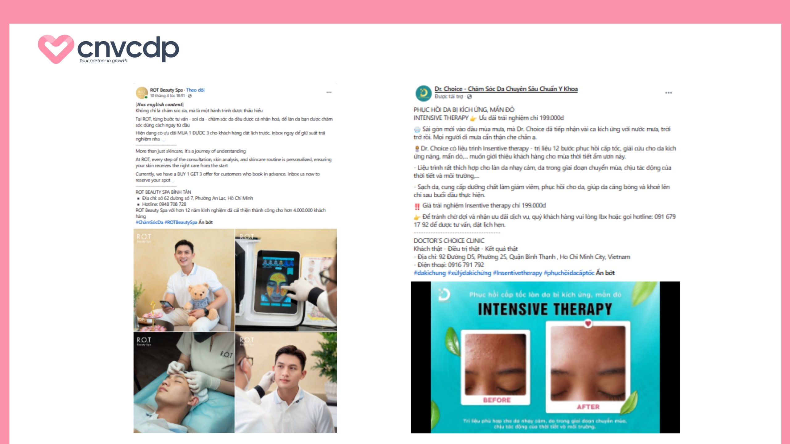 Content Spa chăm sóc da mẫu 3