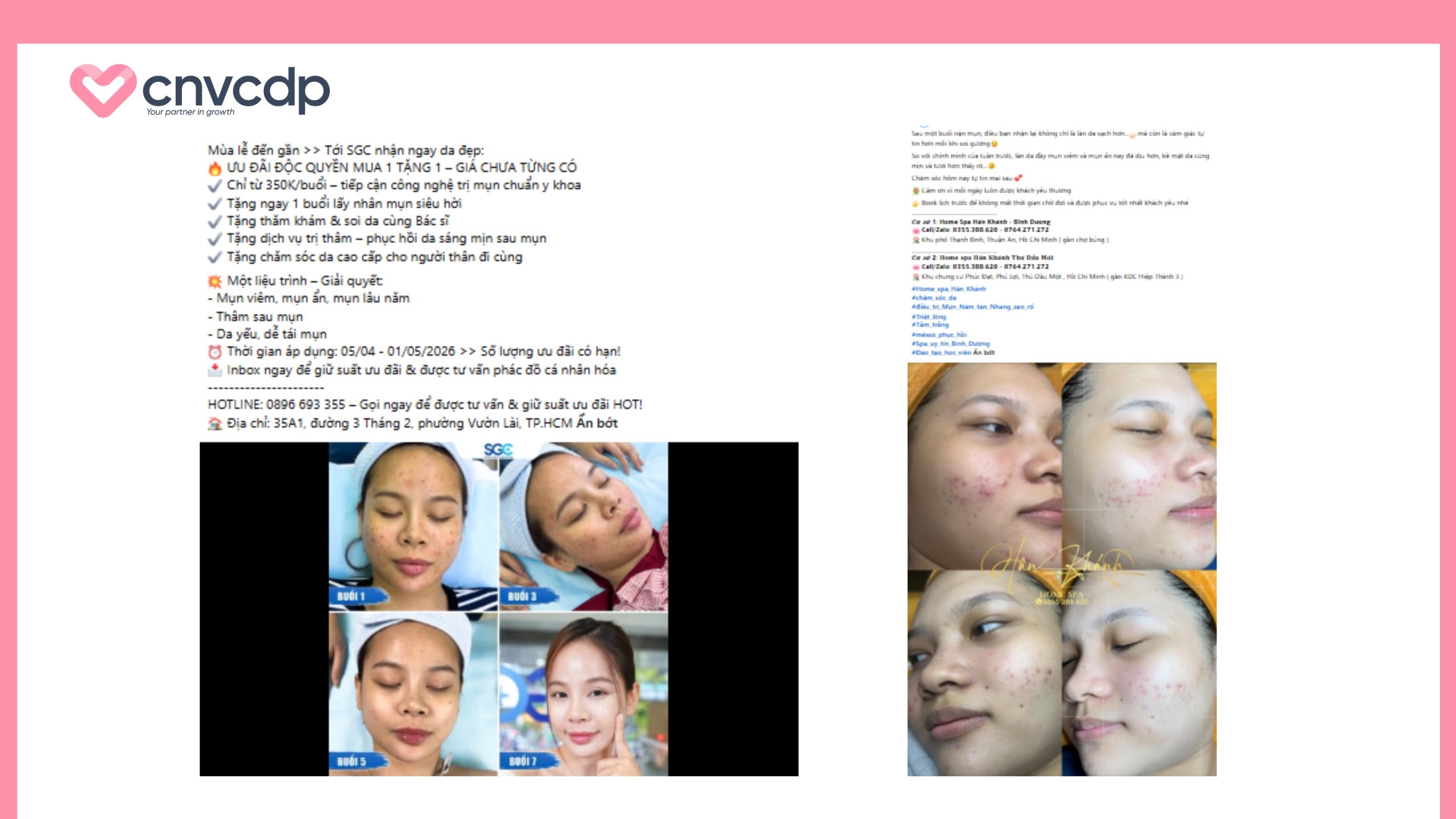 Content Spa review thực tế mẫu 1