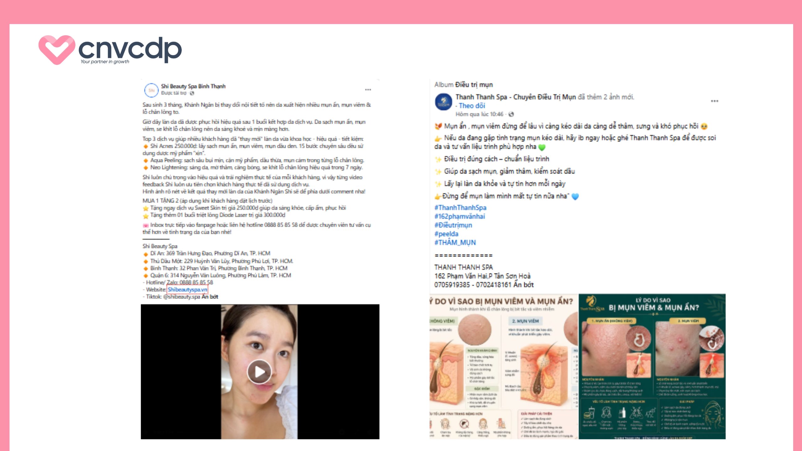 Content Spa review thực tế mẫu 2