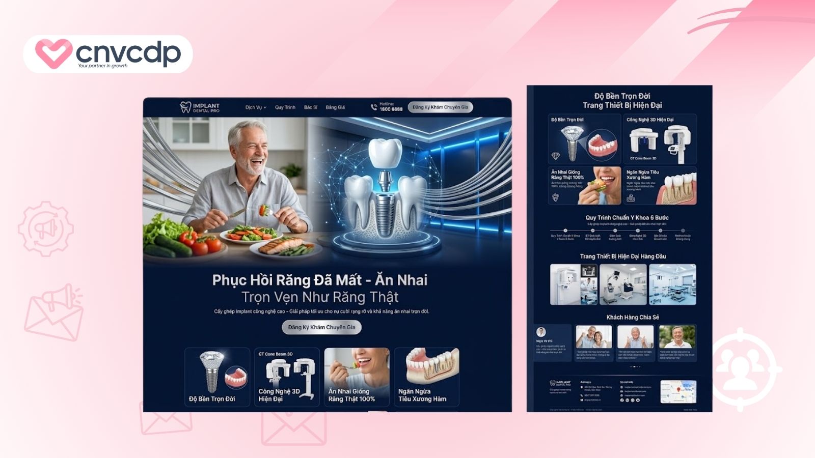 trong rang implant nha khoa